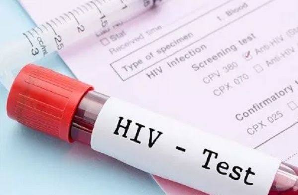     Ghana Records Sharp Decline in HIV Infections and AIDS-Related Deaths