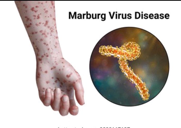 ETHIOPIA MARKS END OF MARBURG VIRUS OUTBREAK THAT KILLED NINE